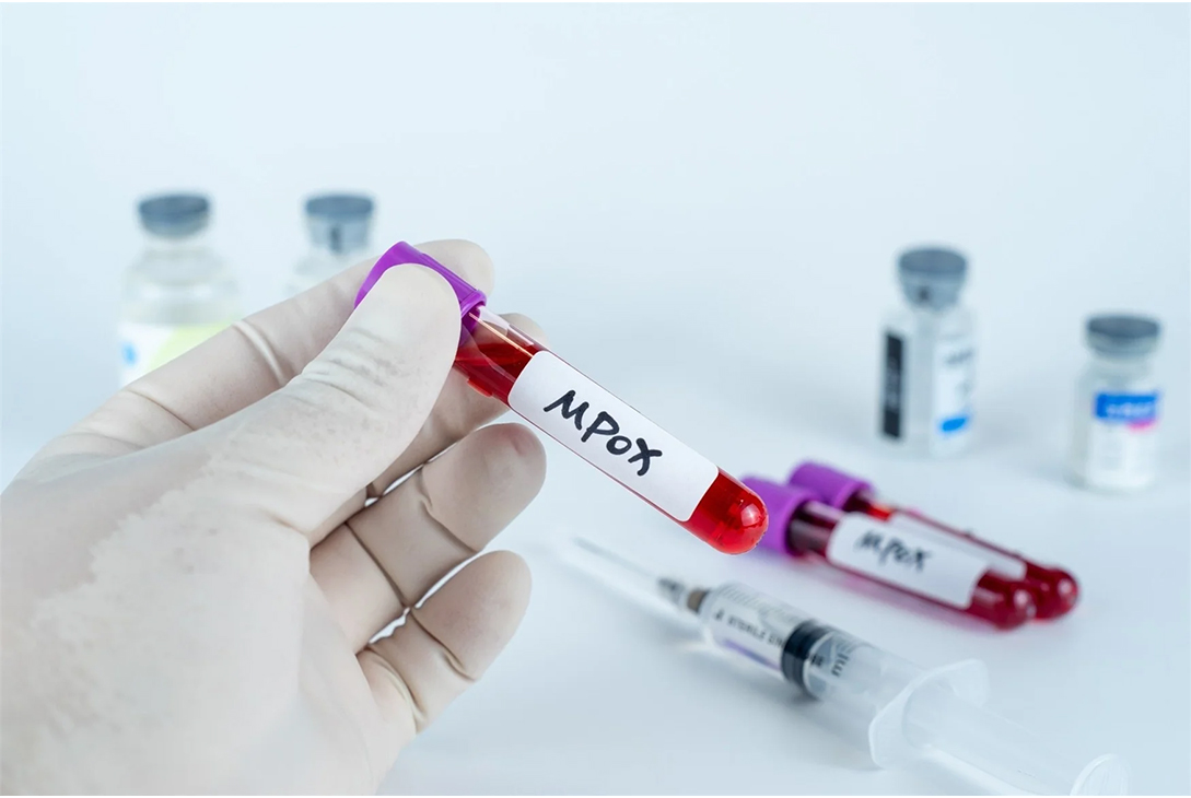 Mpox Explained: Everything You Need to Know About This Viral Threat